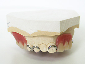 従来の一般義歯