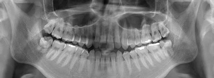 歯科用CT（3D）装置 イメージ画像